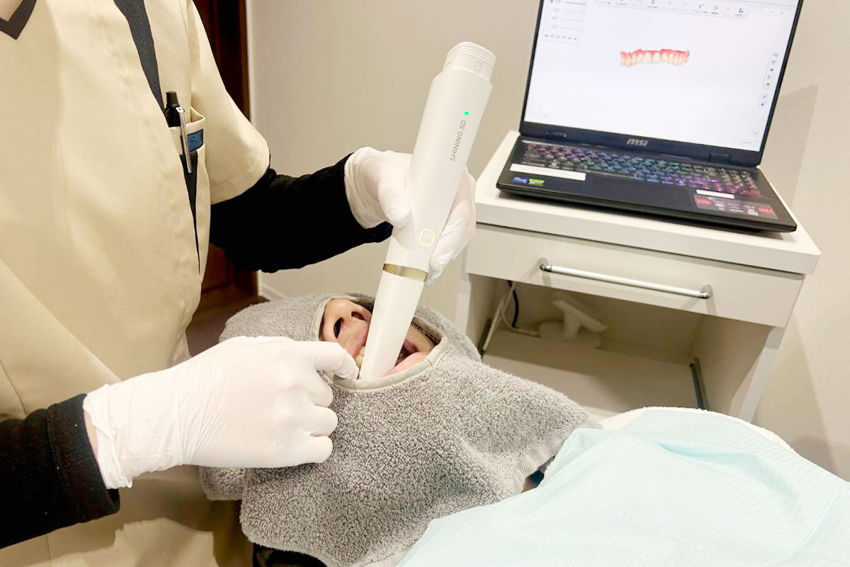 口腔内スキャナーで苦しくない歯型採取